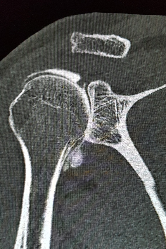 arthroscanner