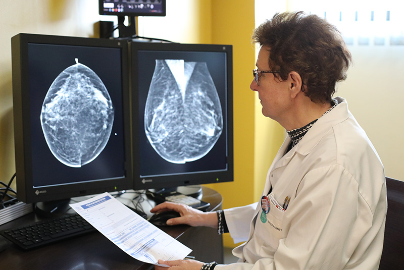 Mammographie et exploration des seins